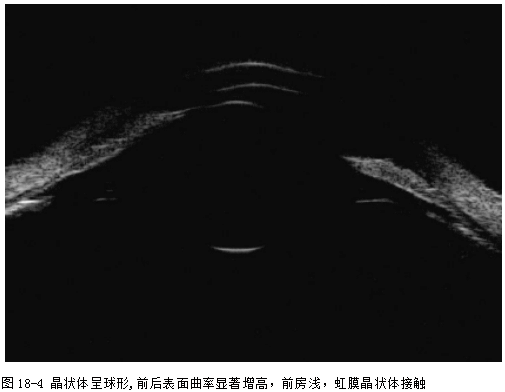 ZY016_91_1.gif
